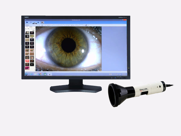 HF4115-RUT Dino-Lite Medical Iriscope Wireless Ready