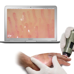 AM4113-N5UT-OB Dino-Lite Fingernail Microcirculation Scope